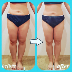 筋膜リリース+リンパドレナージュからの、膝・足首の整骨。
『くるぶしを久しぶりに見た!』
キレイに変身されました✨ ba_0608