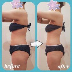 諦めないで!
クーラー・クーの施術で変化をご体感下さい✨ ba_0603